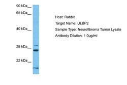 ULBP-2 Antibody, Novus Biologicals 100 &mu;L | Buy Online | Novus Biologicals | Fisher Scientific